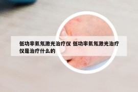 低功率氦氖激光治疗仪 低功率氦氖激光治疗仪是治疗什么的