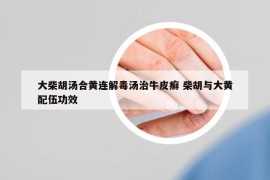 大柴胡汤合黄连解毒汤治牛皮癣 柴胡与大黄配伍功效