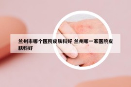 兰州市哪个医院皮肤科好 兰州哪一家医院皮肤科好