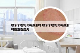 联苯苄唑乳膏有激素吗 联苯苄唑乳膏有激素吗脂溢性皮炎