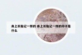身上长胎记一样的 身上长胎记一样的印子是什么