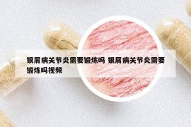 银屑病关节炎需要锻炼吗 银屑病关节炎需要锻炼吗视频