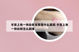 手背上有一块白色皮肤是什么原因 手背上有一块白斑怎么回事