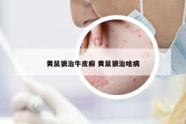 黄鼠狼治牛皮癣 黄鼠狼治啥病