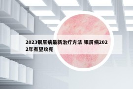 2023银屑病最新治疗方法 银屑病2022年有望攻克