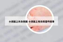 小孩腿上长白斑图 小孩腿上有白斑是咋回事