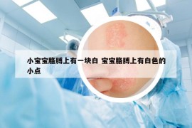 小宝宝胳膊上有一块白 宝宝胳膊上有白色的小点