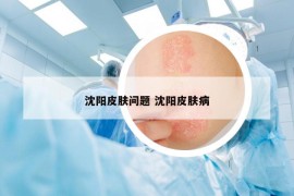 沈阳皮肤问题 沈阳皮肤病