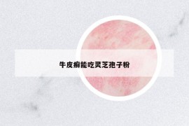 牛皮癣能吃灵芝孢子粉