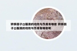 转移因子口服液的功效与作用有哪些 转移因子口服液的功效与作用有哪些呢