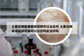 儿童白颠疯病面部初期可以治愈吗 儿童白颠疯病面部初期可以治愈吗能治好吗