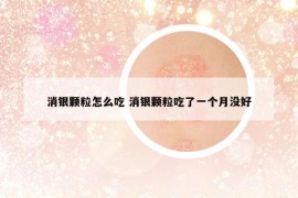 消银颗粒怎么吃 消银颗粒吃了一个月没好