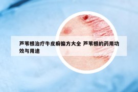 芦苇根治疗牛皮癣偏方大全 芦苇根的药用功效与用途
