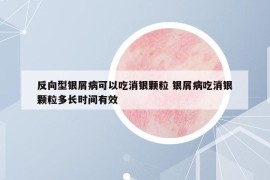反向型银屑病可以吃消银颗粒 银屑病吃消银颗粒多长时间有效
