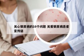 关心银屑病的10个问题 关爱银屑病患者 宣传语