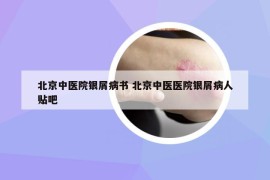 北京中医院银屑病书 北京中医医院银屑病人贴吧