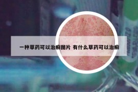 一种草药可以治癣图片 有什么草药可以治癣