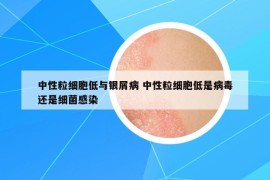 中性粒细胞低与银屑病 中性粒细胞低是病毒还是细菌感染