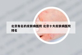 北京有名的皮肤病医院 北京十大皮肤病医院排名