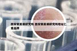 西安银屑病研究所 西安银屑病研究所地址仁爱品牌