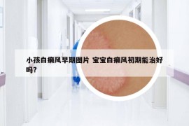 小孩白癞风早期图片 宝宝白癞风初期能治好吗?