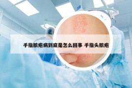 手指脓疱病到底是怎么回事 手指头脓疱