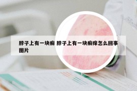 脖子上有一块癣 脖子上有一块癣痒怎么回事图片