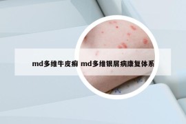 md多维牛皮癣 md多维银屑病康复体系
