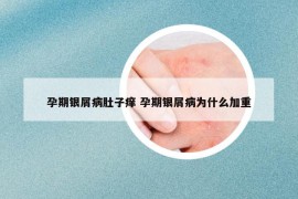 孕期银屑病肚子痒 孕期银屑病为什么加重