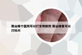 鞍山哪个医院可以打生物制剂 鞍山哪里可以打科兴