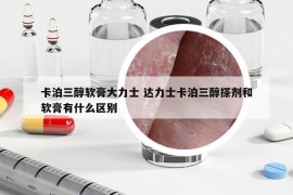 卡泊三醇软膏大力士 达力士卡泊三醇搽剂和软膏有什么区别