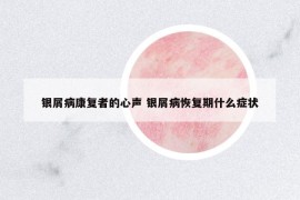 银屑病康复者的心声 银屑病恢复期什么症状
