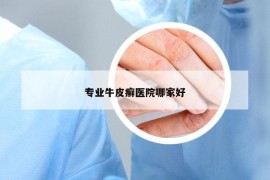 专业牛皮癣医院哪家好