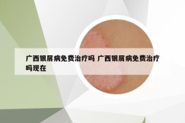 广西银屑病免费治疗吗 广西银屑病免费治疗吗现在