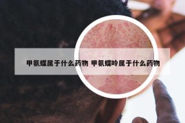 甲氨蝶属于什么药物 甲氨蝶呤属于什么药物