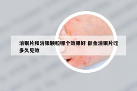 消银片和消银颗粒哪个效果好 郁金消银片吃多久见效