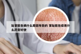 趾掌脓包病什么原因导致的 掌趾脓包症用什么药膏好使