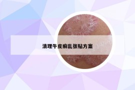 清理牛皮癣乱张贴方案