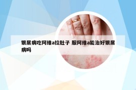 银屑病吃阿维a拉肚子 服阿维a能治好银屑病吗
