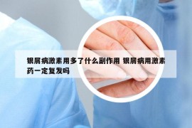 银屑病激素用多了什么副作用 银屑病用激素药一定复发吗