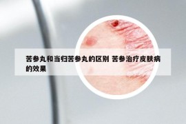 苦参丸和当归苦参丸的区别 苦参治疗皮肤病的效果