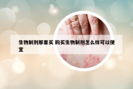 生物制剂那里买 购买生物制剂怎么样可以便宜