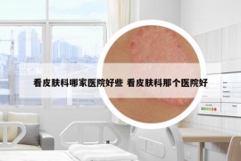看皮肤科哪家医院好些 看皮肤科那个医院好