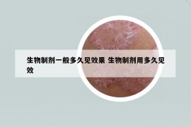 生物制剂一般多久见效果 生物制剂用多久见效