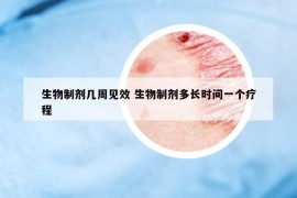 生物制剂几周见效 生物制剂多长时间一个疗程