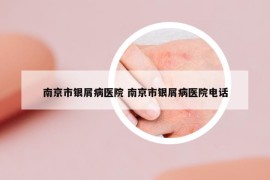 南京市银屑病医院 南京市银屑病医院电话