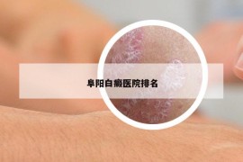 阜阳白癜医院排名