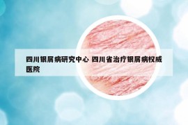 四川银屑病研究中心 四川省治疗银屑病权威医院