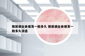 银屑病全身爆发一般多久 银屑病全身爆发一般多久消退
