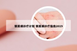 银屑病诊疗计划 银屑病诊疗指南2019